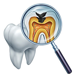 The image shows a magnified view of a tooth with an open crown through which a detailed cross-section reveals the internal structure, including the pulp chamber, root canals, and dentin layers, along with a close-up illustration of a tooth s interior with labeled parts such as enamel, cementum, and dentin.