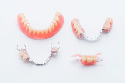 Alt text   A set of three dental bridges with pink resin teeth displayed against a white background.