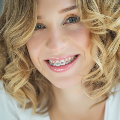 A young woman with straightened teeth, wearing braces, smiling at the camera.