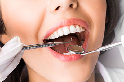 The image shows a woman with an open mouth, receiving dental treatment from a dentist who has tools visible around her mouth.