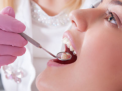 The image shows a dental professional performing a procedure on a patient s mouth, with the dentist using a tool to clean or inspect the teeth.